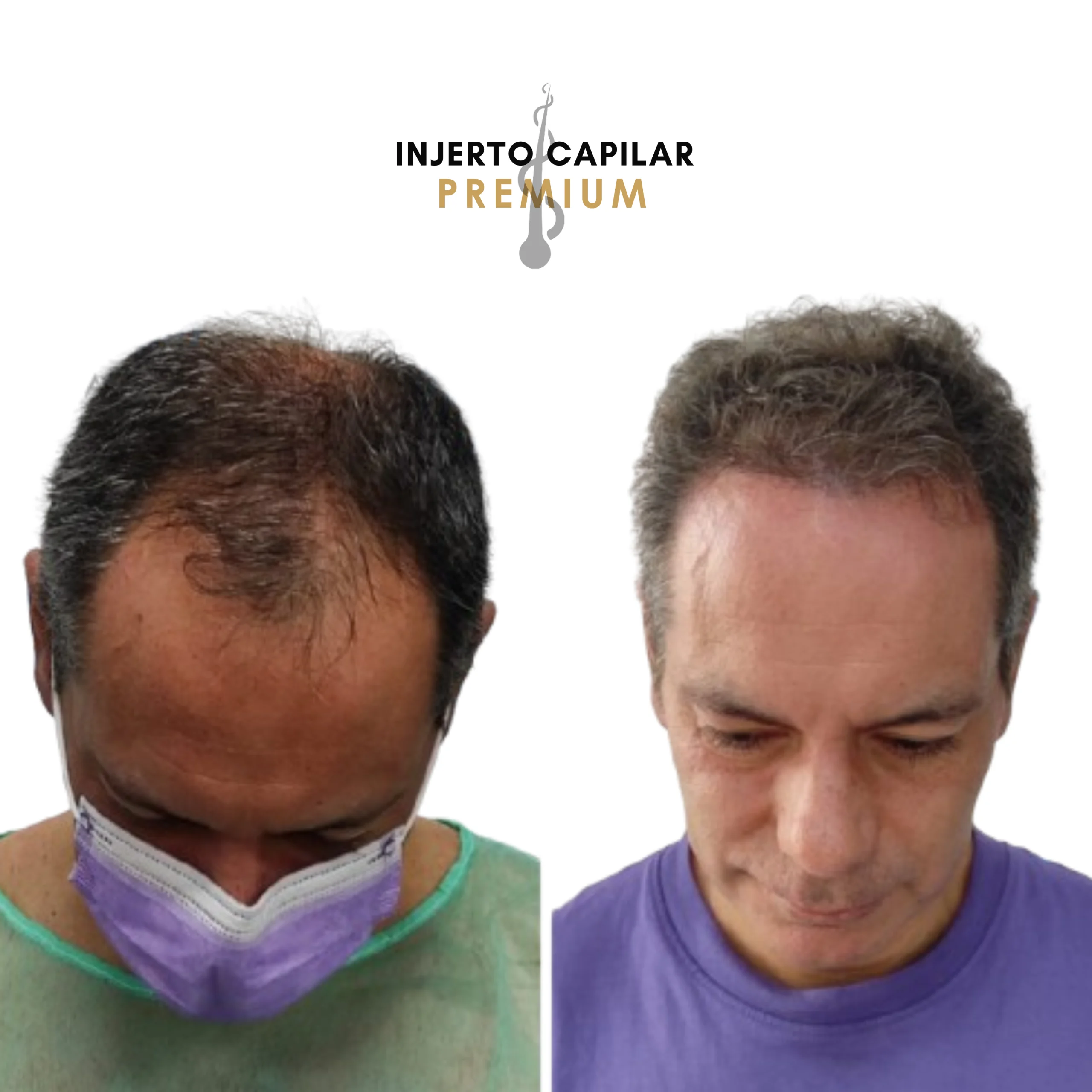 Paciente antes y después