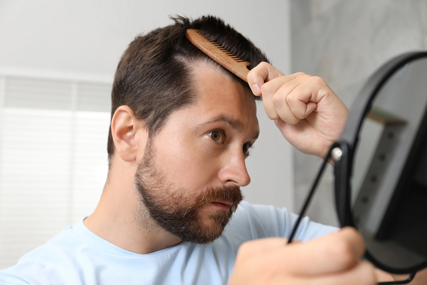 diagnóstico capilar en Sevilla evaluando densidad del cabello antes del injerto capilar