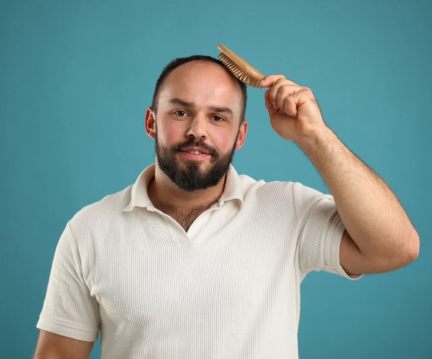 Hombre con alopecia tocando su cabello antes de un injerto capilar en Sevilla