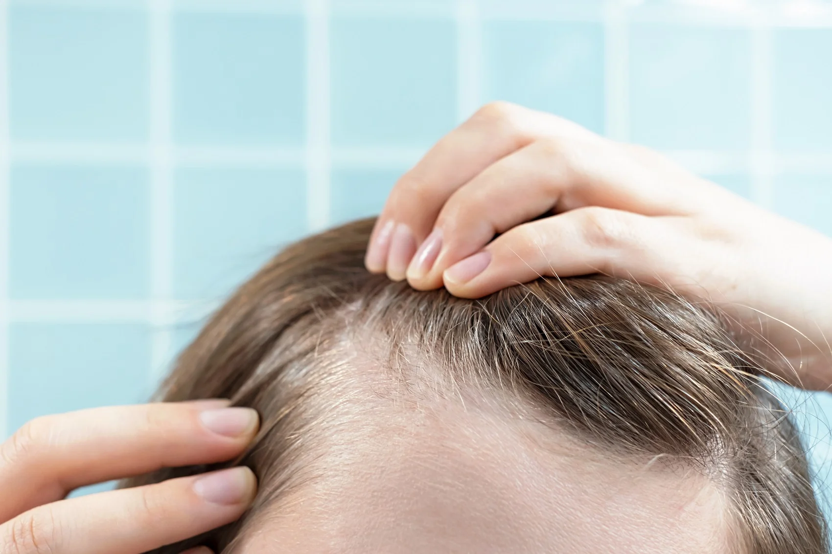 hombre revisando su cabello tras un injerto capilar en Sevilla frente al espejo